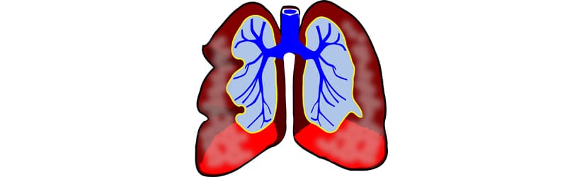 La cigarette électronique met-elle de la vapeur d’eau dans les poumons ?