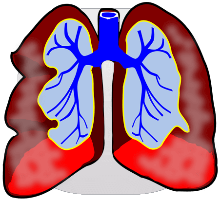La cigarette électronique met-elle de la vapeur d’eau dans les poumons ?